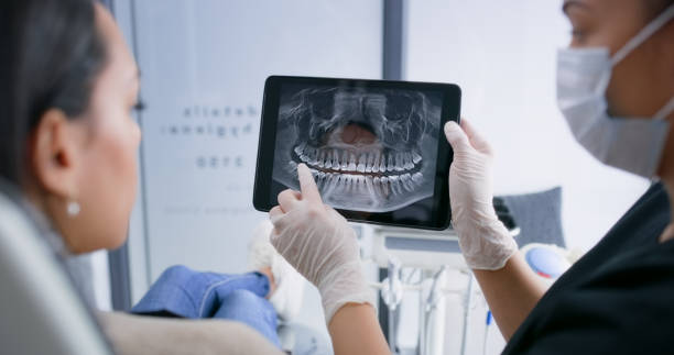 Licensed Tooth Extraction service in Riverton, UT - Smile Center Dentistry